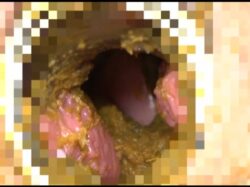 【FetishJapan】排便う○こで膣内掻き回し自慰 #005 SFJ6-092-05