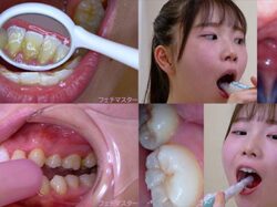 藤田ゆずの歯観察 特別企画シリーズ1〜2まとめてDL